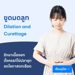 ขูดมดลูก (d/c)