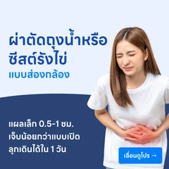 ผ่าตัดถุงน้ำหรือซีสต์รังไข่ (แบบส่องกล้อง)