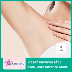 คอร์สเลเซอร์กำจัดขนรักแร้ 4 พลังงาน เครื่องแท้ Primelase จากสเปน 3 ครั้ง (1 สิทธิ์/ท่าน)
