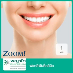 ฟอกสีฟันที่คลินิก ด้วยระบบ Zoom 1 ครั้ง