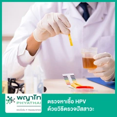 ตรวจหาเชื้อ HPV DNA ด้วยวิธีตรวจปัสสาวะ สำหรับผู้หญิงหรือผู้ชาย