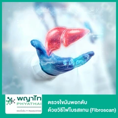 ตรวจไขมันพอกตับ ด้วยวิธีไฟโบรสแกน (Fibroscan)