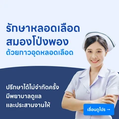 รักษาหลอดเลือดสมองโป่งพอง ด้วยกาวอุดหลอดเลือด