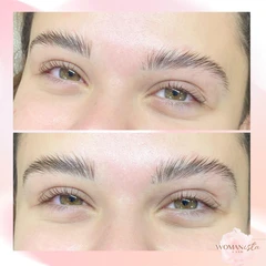 ยกโคนขนคิ้ว 2 ข้าง 1 ครั้ง