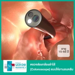 ตรวจส่องกล้องลำไส้ (Colonoscope) แบบให้ยานอนหลับ สำหรับผู้ที่อายุ 15-65 ปี