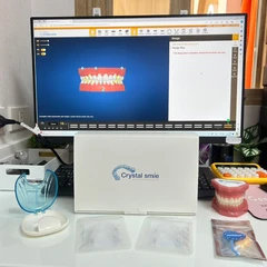จัดฟันแบบใส Crystal Smile ฟันบนและล่าง