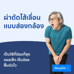 ผ่าตัดไส้เลื่อน (แบบส่องกล้อง)