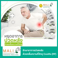 รักษาอาการปวดหลัง ด้วยคลื่นความถี่วิทยุ Coolife (RF)