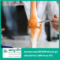 ตรวจสนามแม่เหล็กไฟฟ้าส่วนกระดูก บริเวณเข่าขวา (MRI Knee RT)