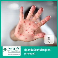 ฉีดวัคซีนป้องกันโรคงูสวัด (Shingrix) 2 เข็ม