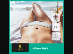 กำจัดขน Bikini ด้วย IPL 1 ครั้ง สำหรับผู้หญิงเท่านั้น
