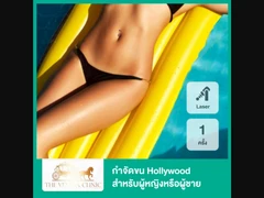 กำจัดขน Hollywood ด้วย Diode Laser เครื่อง Diolaze XL 1 ครั้ง สำหรับผู้หญิงหรือผู้ชาย