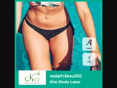 คอร์สกำจัดขน Bikini ด้วย Diode Laser 3 ครั้ง ภายใน 3 เดือน สำหรับผู้หญิง