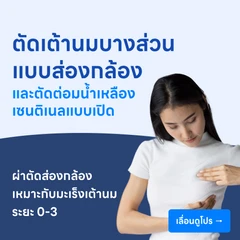 ผ่าตัดเต้านมออกเพียงบางส่วนแบบส่องกล้อง +ผ่าตัดต่อมน้ำเหลืองเซนติเนลแบบเปิด