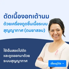 ผ่าตัดเนื้องอกเต้านม 1 ก้อน ด้วยเข็มขนาดใหญ่ โดยใช้เครื่องเจาะดูดชิ้นเนื้อระบบสุญญากาศ (ดมยาสลบ)