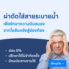 ผ่าตัดรักษาภาวะน้ำคั่งในโพรงสมอง ด้วยการใส่ท่อระบายน้ำจากโพรงสมองเข้าสู่ช่องท้อง