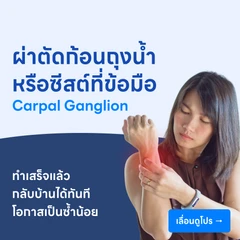 ผ่าตัดก้อนถุงน้ำหรือซีสต์ที่ข้อมือ (Carpal Ganglion)