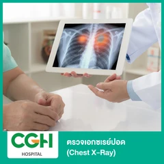 ตรวจเอกซเรย์ปอด (Chest X-Ray)