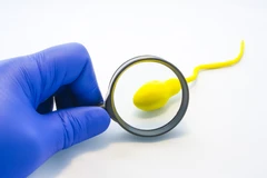 ตรวจวิเคราะห์คุณภาพอสุจิ (Sperm Analysis) เพื่อเตรียมมีบุตร ไม่มีพบแพทย์