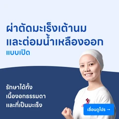 ผ่าตัดมะเร็งเต้านม พร้อมตัดต่อมน้ำเหลืองออก (แบบเปิด)