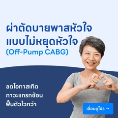 ผ่าตัดบายพาสหัวใจ เทคนิคหัวใจไม่หยุดเต้น (Off-Pump CABG)