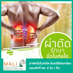 ผ่าตัดนิ่วในท่อไต ด้วยวิธีส่องกล้อง (Ureterolithotomy) นอนพักที่ รพ. 2 วัน 1 คืน