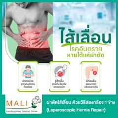 ผ่าตัดไส้เลื่อน ด้วยวิธีส่องกล้อง 1 ข้าง (Laparoscopic Hernia Repair) นอนพักที่ รพ. 3 วัน 2 คืน