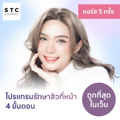 โปรแกรมรักษาสิวทั่วใบหน้า 4 ขั้นตอน 4 ครั้ง ฟรี! 1 ครั้ง