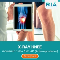 เอกซเรย์เข่า 1 ข้าง ในท่า AP (Anteroposterior)