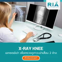 เอกซเรย์เข่า เพื่อตรวจดูภาวะเข่าเสื่อม 2 ข้าง