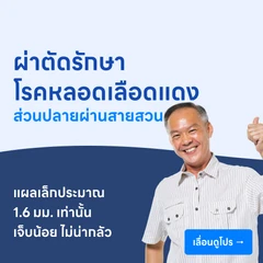 ผ่าตัดรักษาโรคหลอดเลือดแดงส่วนปลายผ่านสายสวน