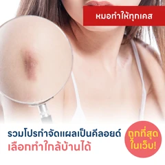 รวมโปรรักษาแผลเป็นคีลอยด์ ถูกที่สุดในเว็บ เลือกทำใกล้บ้านได้