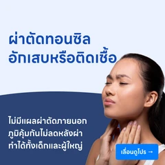 ผ่าตัดทอนซิล