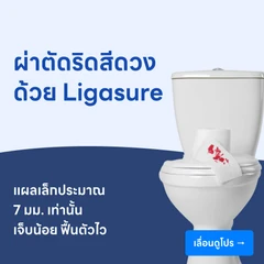 ผ่าตัดริดสีดวงทวารด้วยเครื่อง Ligasure