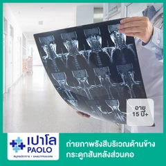 ถ่ายภาพรังสีบริเวณด้านข้างกระดูกสันหลังส่วนคอ สำหรับผู้ที่อายุ 15 ปีขึ้นไป