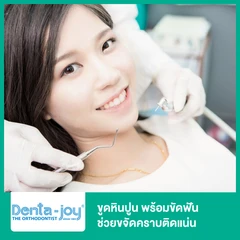 ขูดหินปูน พร้อมขัดฟันด้วยเครื่อง Airflow ช่วยขจัดคราบติดแน่น