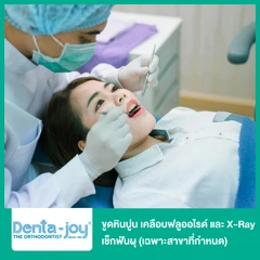 ขูดหินปูน พร้อมเคลือบฟลูออไรด์ และเอกซเรย์เช็กฟันผุ 2 ฟิล์ม (เฉพาะสาขาที่กำหนด)