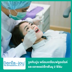 ขูดหินปูน พร้อมเคลือบฟลูออไรด์ และเอกซเรย์เช็กฟันผุ 2 ฟิล์ม