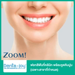 ฟอกสีฟันที่คลินิก ด้วยระบบ Zoom พร้อมขูดหินปูน (เฉพาะสาขาที่กำหนด)
