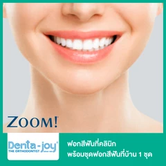 ฟอกสีฟันที่คลินิก ด้วยระบบ Zoom พร้อมชุดฟอกสีฟันที่บ้าน 1 ชุด