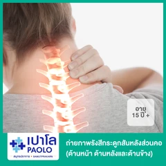 ถ่ายภาพรังสีกระดูกสันหลังส่วนคอ (ด้านหน้า ด้านหลังและด้านข้าง) สำหรับผู้ที่อายุ 15 ปีขึ้นไป