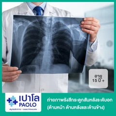 ถ่ายภาพรังสีกระดูกสันหลังระดับอก (ด้านหน้า ด้านหลังและด้านข้าง) สำหรับผู้ที่อายุ 15 ปีขึ้นไป
