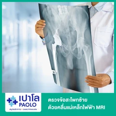 ตรวจข้อสะโพกซ้าย ด้วยคลื่นแม่เหล็กไฟฟ้า (MRI LT Hip)