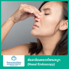 ส่องกล้องตรวจโพรงจมูก (Nasal Endoscopy)