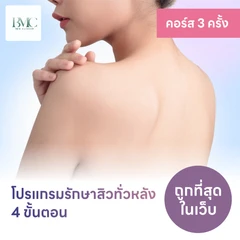 คอร์สโปรแกรมรักษาสิวทั่วแผ่นหลัง 4 ขั้นตอน 2 ครั้ง ฟรี! 1 ครั้ง