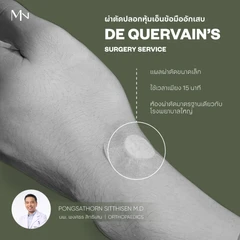 ผ่าตัดโรคปลอกหุ้มเอ็นนิ้วอักเสบ (De Quervain's Disease)