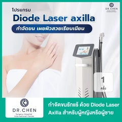 เลเซอร์ Diode Laser Axilla กำจัดขนรักแร้ 1 ครั้ง