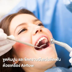 ขูดหินปูน ขัดฟันด้วยเครื่อง Airflow ช่วยขจัดคราบติดแน่น
