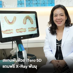 สแกนฟัน ด้วยระบบ iTero 5D ฟรี! เอกซเรย์ (X-Ray) ฟันผุ