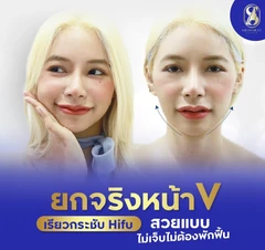 โปรแกรม Ultra Lift ทั่วหน้า (จำนวนช็อตขึ้นอยู่กับแพทย์ประเมิน)